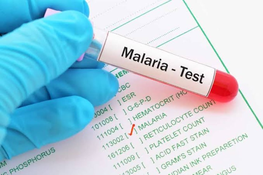 Diagnosa Malaria