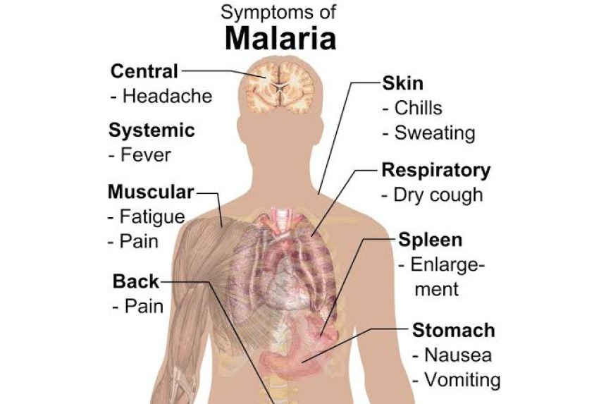 Gejala Malaria